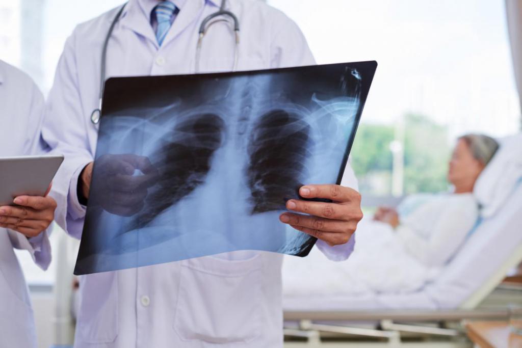Normes pour le traitement de la pneumonie chez les adultes