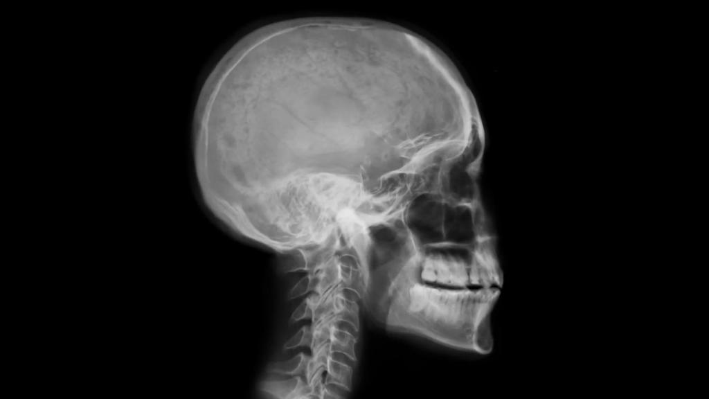 Aide avec TBI
