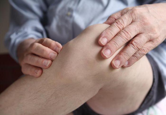  knee replacement