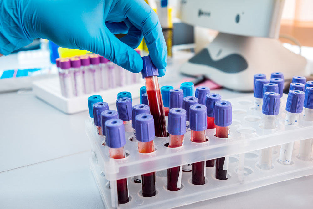 Examination blood test